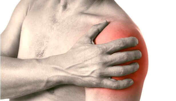 Une épaule enflée, rouge et hypertrophiée - symptômes d'arthrose de grade 2-3 de l'articulation de l'épaule