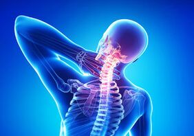 Signes d'ostéochondose cervicale