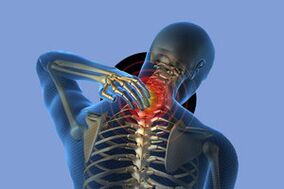 Symptômes de l'ostéochondose cervicale
