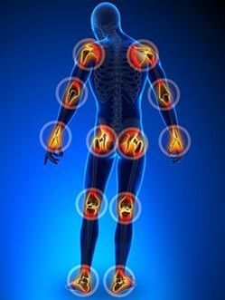 Localisation des articulations affectées par l'arthrose
