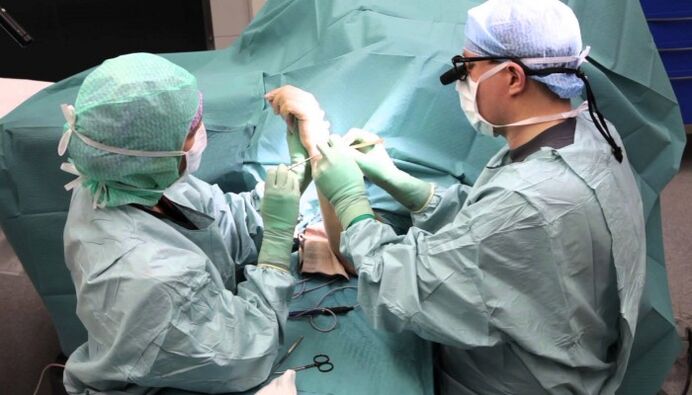 traitement chirurgical de la douleur dans les articulations des doigts